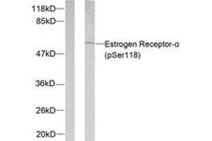 Western blot analysis of extracts from MCF7 cells treated with Estradiol, using Estrogen Receptor-alpha (Phospho-Ser118) Antibody. (Estrogen Receptor alpha anticorps  (pSer118))