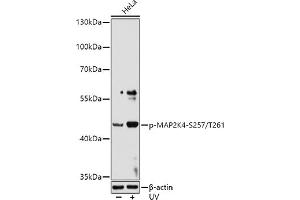 Western blot analysis of extracts of HeLa cells, using Phospho-MK4-S257/T261 antibody (ABIN6135256, ABIN6136136, ABIN6136137 and ABIN6225569) at 1:1000 dilution. (MAP2K4 anticorps  (pSer257, pThr261))