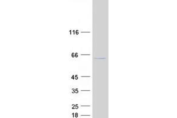 GTF3C5 Protein (Transcript Variant 2) (Myc-DYKDDDDK Tag)