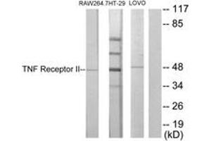 Western blot analysis of extracts from RAW264. (TNFRSF1B anticorps  (AA 376-425))