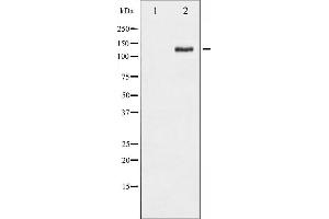 Western blot analysis of FAK phosphorylation expression in PMA treated HepG2 whole cell lysates,The lane on the left is treated with the antigen-specific peptide. (FAK anticorps  (pSer843))