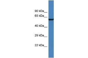 Western Blotting (WB) image for anti-Adhesion Molecule with Ig-Like Domain 2 (AMIGO2) (N-Term) antibody (ABIN2156368) (AMIGO2 anticorps  (N-Term))