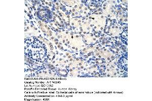 Rabbit Anti-RNASEH2A Antibody  Paraffin Embedded Tissue: Human Kidney Cellular Data: Epithelial cells of renal tubule Antibody Concentration: 4. (RNASEH2A anticorps  (C-Term))