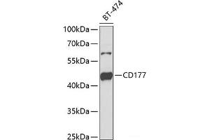 Western blot analysis of extracts of BT-474 cells using CD177 Polyclonal Antibody at dilution of 1:1000. (CD177 anticorps)
