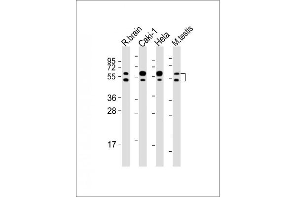 CDKL3 anticorps  (AA 2-34)