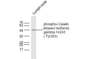 Mouse lymph node lysates probed with Casein kinase I isoforms gamma 1+2+3 (Tyr263) Polyclonal Antibody, unconjugated  at 1:300 overnight at 4°C followed by a conjugated secondary antibody at 1:10000 for 60 minutes at 37°C. (CSNK1G1, CSNK1G2, CSNK1G3 (pTyr263) anticorps)