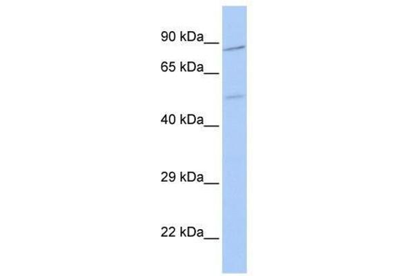 ZNF585B anticorps  (N-Term)