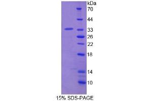 SDS-PAGE (SDS) image for Lymphocyte-Specific Protein 1 (LSP1) (AA 126-330) protein (His tag) (ABIN6238865) (LSP1 Protein (AA 126-330) (His tag))