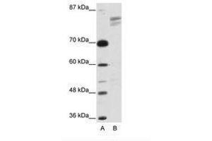 Image no. 1 for anti-General Transcription Factor III (GTF2I) (AA 208-257) antibody (ABIN203263) (GTF2I anticorps  (AA 208-257))