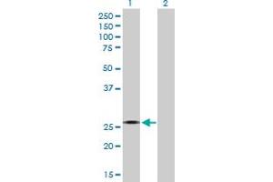 Western Blot analysis of CYB5R2 expression in transfected 293T cell line by CYB5R2 MaxPab polyclonal antibody. (CYB5R2 anticorps  (AA 1-237))