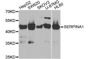 Western blot analysis of extracts of various cell lines, using SERPINA1 antibody. (SERPINA1 anticorps)
