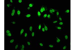 Immunofluorescence staining of Hela cells with ABIN7127304 at 1:60,counter-stained with DAPI. (Recombinant HIST1H3A anticorps  (H3R2me))