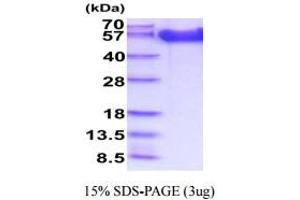 SDS-PAGE (SDS) image for Fibroblast Growth Factor Receptor 1 (FGFR1) (AA 22-376) protein (His tag) (ABIN5854969) (FGFR1 Protein (AA 22-376) (His tag))