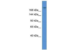 Western Blot showing TPR antibody used at a concentration of 1 ug/ml against 721_B Cell Lysate (TPR anticorps  (C-Term))