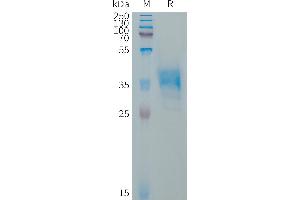 Human Protein, hFc Tag on SDS-PAGE under reducing condition. (GPR65 Protein (AA 1-15) (Fc Tag))