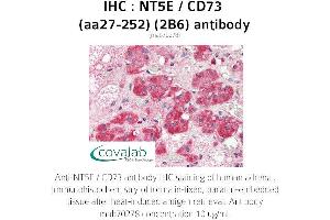 Image no. 1 for anti-5'-Nucleotidase, Ecto (CD73) (NT5E) (AA 27-252) antibody (ABIN1723204) (CD73 anticorps  (AA 27-252))