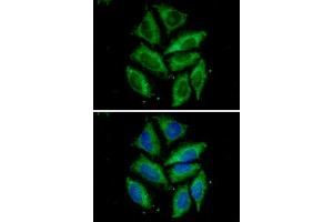 ICC/IF analysis of Tomm20 in HeLa cells. (TOMM20 anticorps)