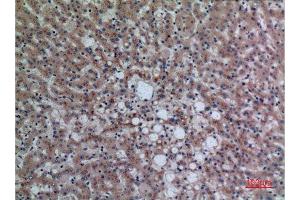 Immunohistochemistry (IHC) analysis of paraffin-embedded Human Liver, antibody was diluted at 1:100. (DPP7 anticorps  (C-Term))