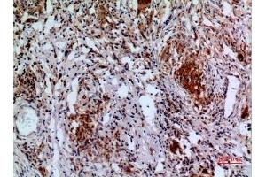 Immunohistochemical analysis of paraffin-embedded human-lung, antibody was diluted at 1:100. (APAF1 anticorps  (Internal Region))