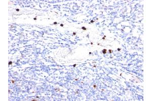 Formalin-fixed, paraffin-embedded human Tonsil stained with G-CSF Mouse Monoclonal Antibody (CSF3/900). (G-CSF anticorps)