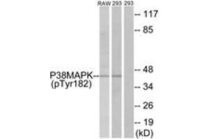Western Blotting (WB) image for anti-Mitogen-Activated Protein Kinase 14 (MAPK14) (pTyr182) antibody (ABIN2888496) (MAPK14 anticorps  (pTyr182))