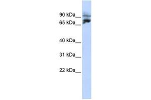 KIF2A antibody used at 1 ug/ml to detect target protein. (KIF2A anticorps  (N-Term))