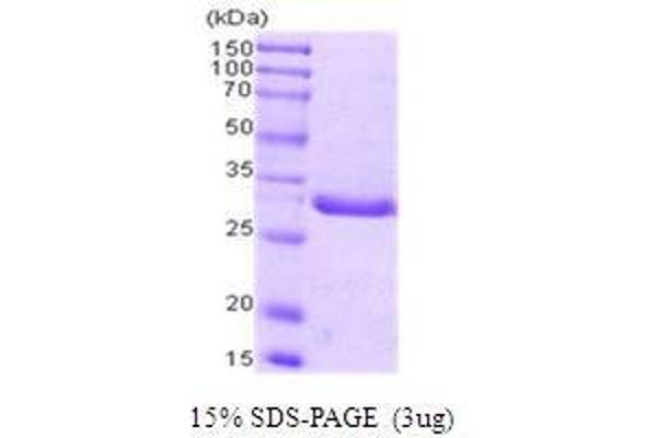 PCNA Protein (AA 1-261)