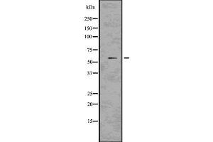 Western blot analysis NLK using HT-29 whole cell lysates (Nemo-Like Kinase anticorps  (N-Term))