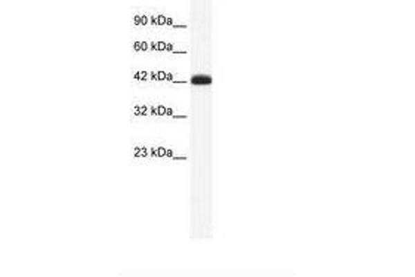 SLC2A4RG anticorps  (AA 217-266)