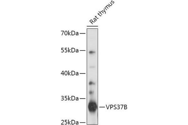 VPS37B anticorps  (AA 60-170)