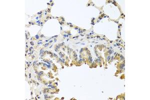 Immunohistochemistry of paraffin-embedded mouse lung using Bax antibody (ABIN5970040) at dilution of 1/100 (40x lens). (BAX anticorps)