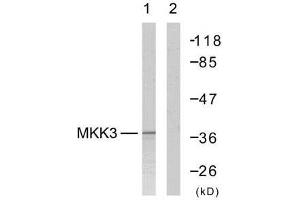 Western blot analysis of extract from MDA-MB-435 cells, using MKK3 (Ab-189) antibody (E021116). (MAP2K3 anticorps)