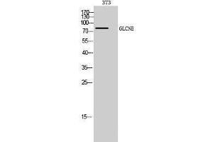 Western Blotting (WB) image for anti-Glucosamine (UDP-N-Acetyl)-2-Epimerase/N-Acetylmannosamine Kinase (GNE) (C-Term) antibody (ABIN3175276) (GNE anticorps  (C-Term))