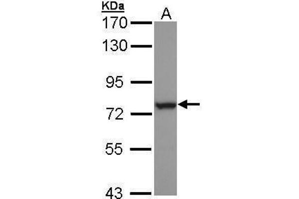 HSPA6 anticorps  (Center)