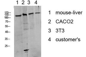 Western Blot analysis of various cells using Phospho-DDR1 (Tyr513) Polyclonal Antibody at dilution of 1:1000. (DDR1 anticorps  (pTyr513))