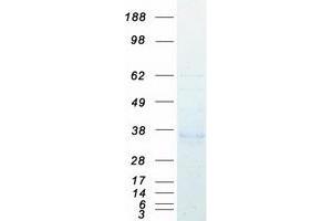 Validation with Western Blot (ACP5 Protein (Transcript Variant 4) (Myc-DYKDDDDK Tag))