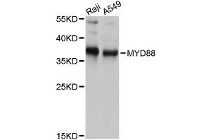Western blot analysis of extracts of various cell lines, using MYD88 antibody. (MYD88 anticorps)