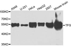 Western blot analysis of extracts of various cell lines, using TFG antibody (ABIN5975639) at 1/1000 dilution. (TFG anticorps)