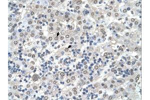 CDR2 antibody was used for immunohistochemistry at a concentration of 4-8 ug/ml. (CDR2 anticorps  (N-Term))