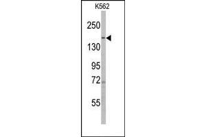 Image no. 1 for anti-PH Domain and Leucine Rich Repeat Protein Phosphatase 1 (PHLPP1) (N-Term) antibody (ABIN360194) (PHLPP1 anticorps  (N-Term))