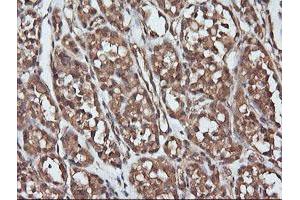 Image no. 1 for anti-Parvin, alpha (PARVA) antibody (ABIN1496441) (Parvin alpha anticorps)