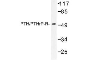 Image no. 1 for anti-Parathyroid Hormone 1 Receptor (PTH1R) antibody (ABIN317698) (PTH1R anticorps)