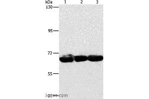 Western blot analysis of 293T, hepG2 and A549 cell, using CKAP4 Polyclonal Antibody at dilution of 1:750 (CKAP4 anticorps)