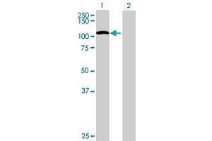 Lane 1: TMEM24 transfected lysate ( 76. (TMEM24 293T Cell Transient Overexpression Lysate(Denatured))