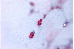 Human Bone, Cartilage (formalin-fixed, paraffin-embedded) stained with ACAN antibody ABIN625841 at 7 ug/ml followed by biotinylated goat anti-rabbit IgG secondary antibody ABIN481713, alkaline phosphatase-streptavidin and chromogen. (Aggrecan anticorps  (N-Term))