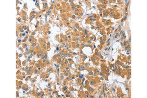 Immunohistochemistry (IHC) image for anti-Charged Multivesicular Body Protein 4B (CHMP4B) antibody (ABIN2423156) (CHMP4B anticorps)