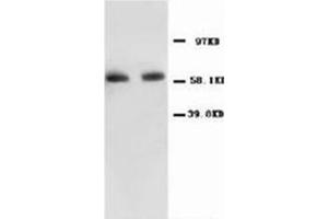 Western blot with NFκBP65 Polyclonal Antibody (NF-kB p65 anticorps  (N-Term))