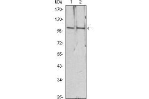 Western blot analysis using HDAC4 mouse mAb against Hela (1), Jurkat (2) cell lysate. (HDAC4 anticorps)