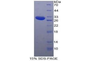 SDS-PAGE analysis of Human SSFA2 Protein. (SSFA2 Protéine)