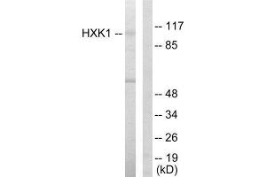 Western Blotting (WB) image for anti-Hexokinase 1 (HK1) (N-Term) antibody (ABIN1849225) (Hexokinase 1 anticorps  (N-Term))